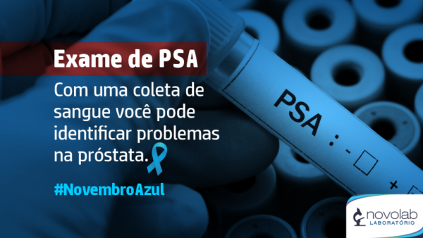 Exame De PSA NovoLab